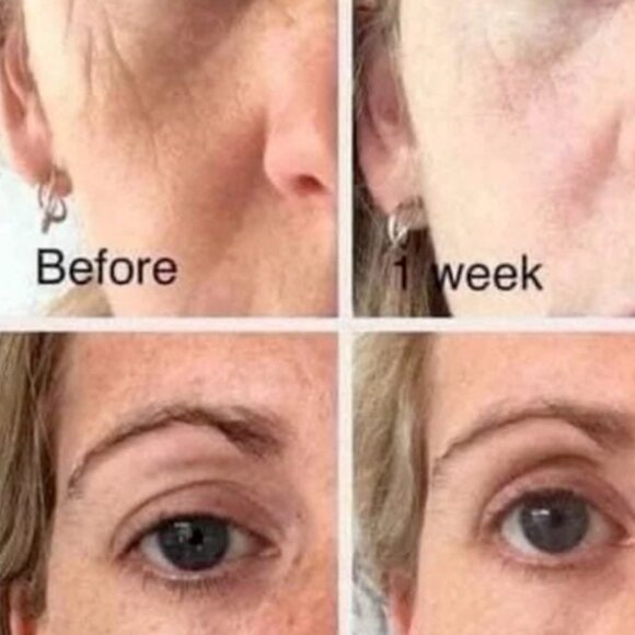 HERMETISE PROFESSIONAL EYE CREAM-REDUCES PUFFINESS-1.02 fl oz / 30 ml-NEW-SEALED - Picture 6 of 6